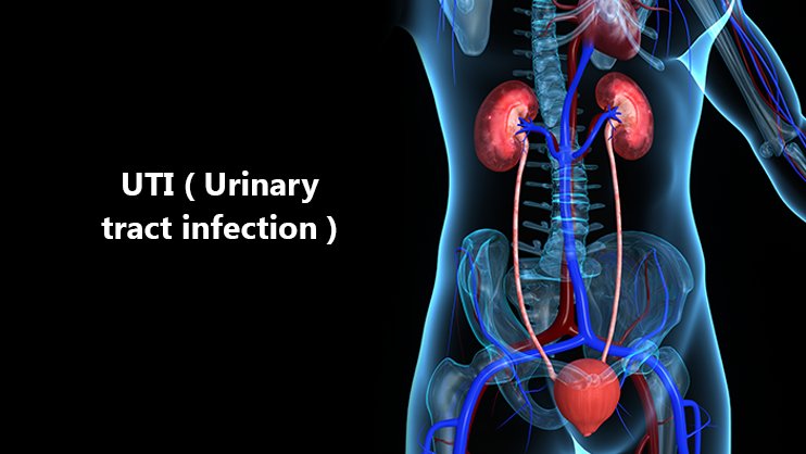 lifestyleug.com__urinary tract infection (UTI)