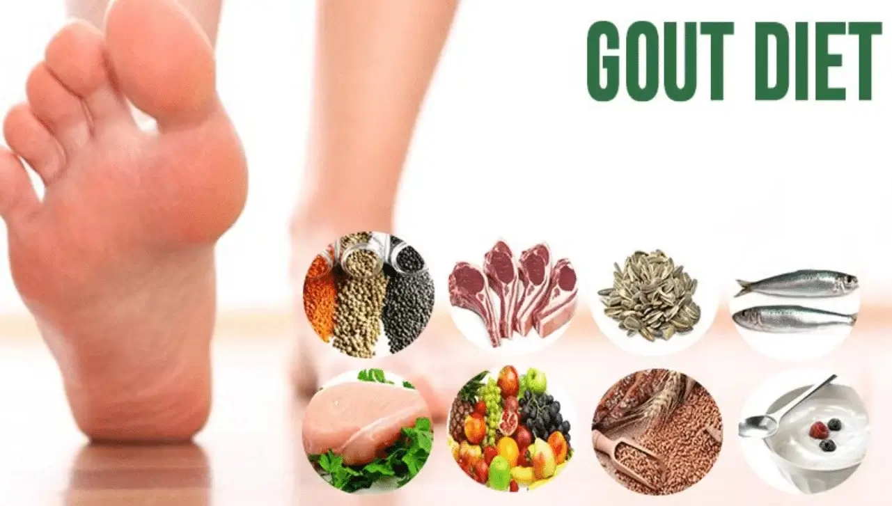 gout diet plan
